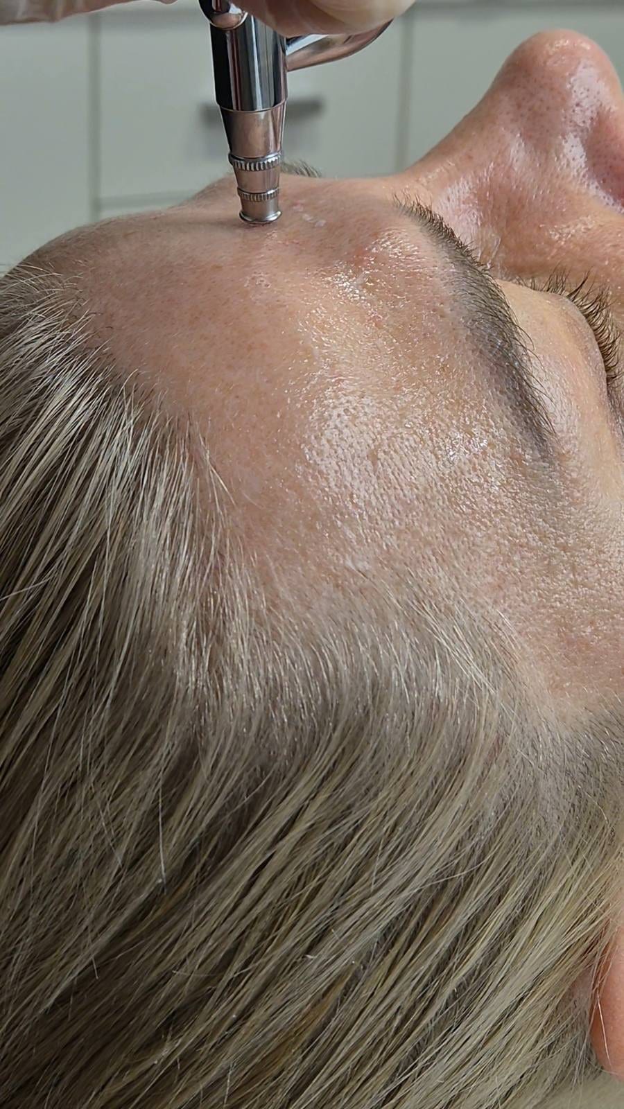 Intraceuticals - кислородна хидратация — снимка 5 от 12