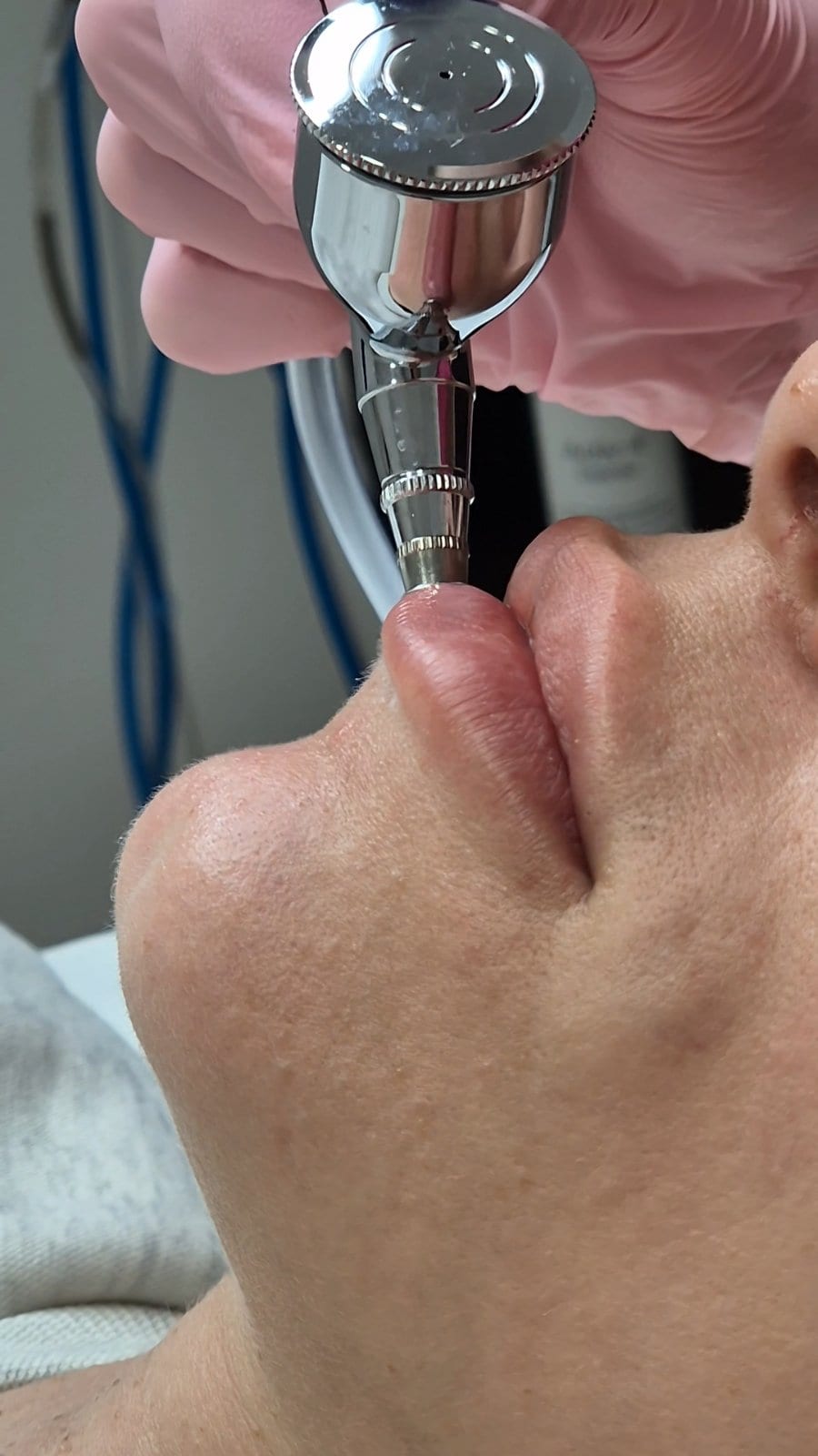 Intraceuticals - кислородна хидратация — снимка 6 от 12