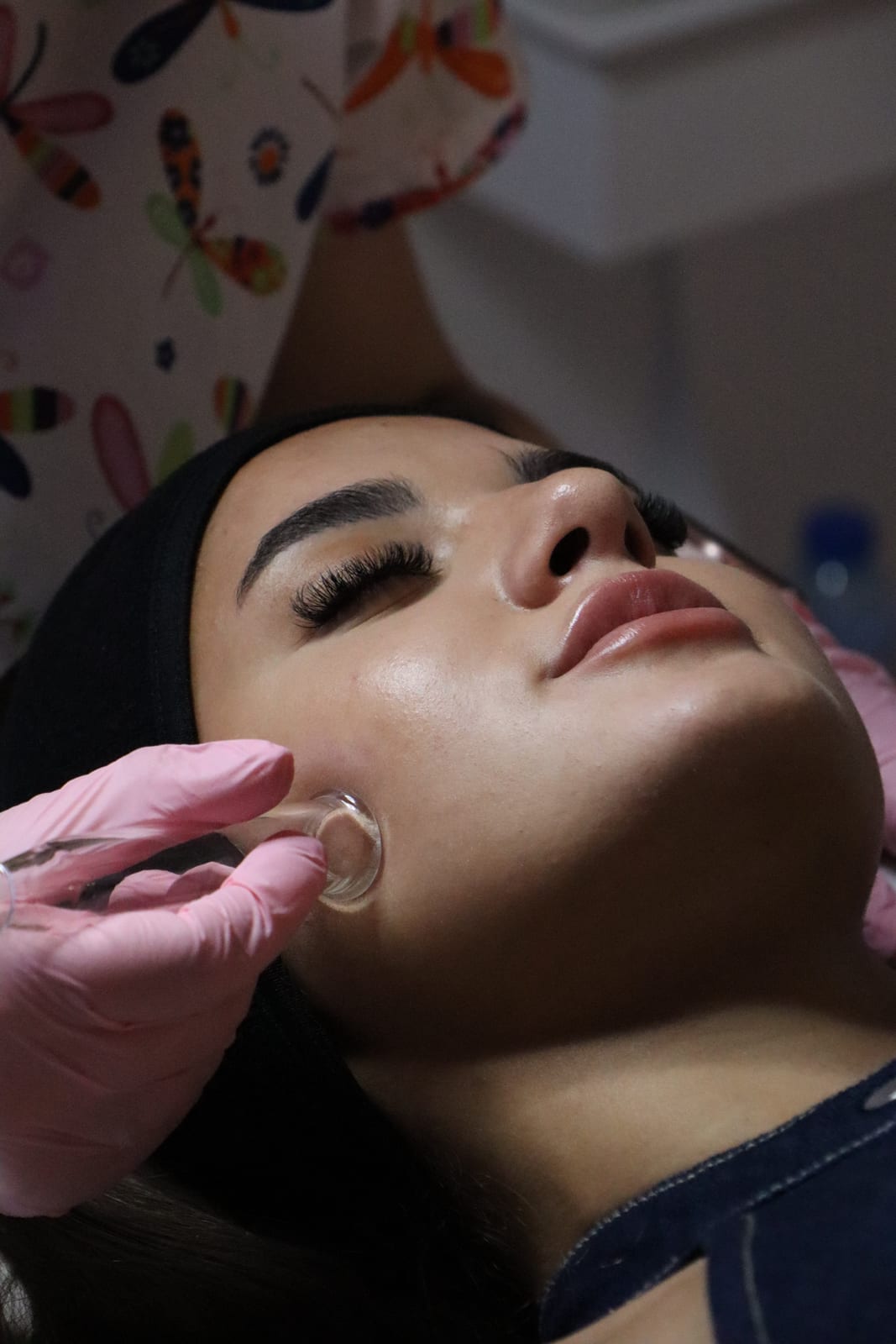 HydraFacial — снимка 11 от 11