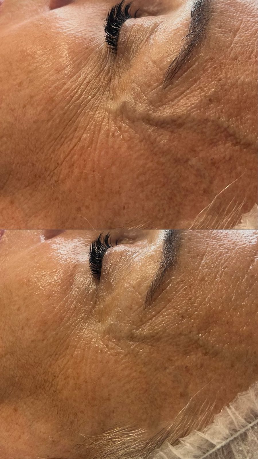 Intraceuticals - кислородна хидратация — снимка 8 от 12