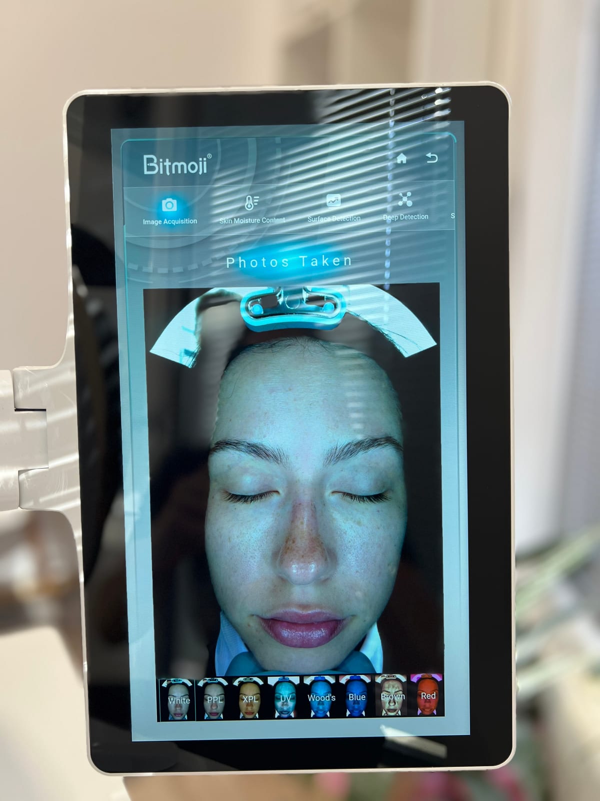 3D Skincheck — снимка 2 от 2