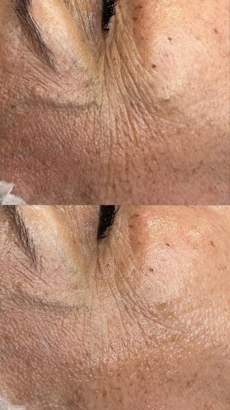 Intraceuticals - кислородна хидратация — снимка 9 от 12